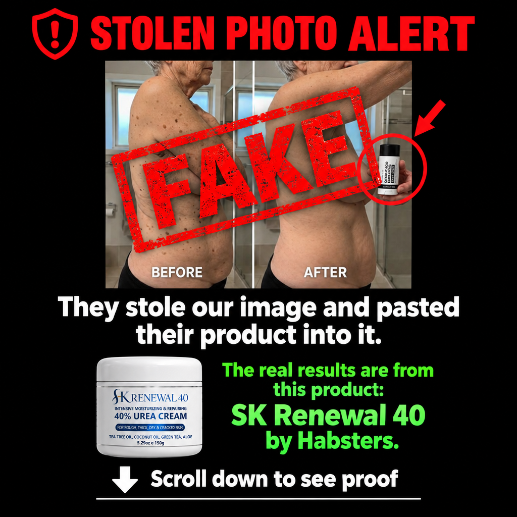 SK Renewal 40™ — Advanced Keratolytic Cream For Rough, Raised Seborrheic Keratoses