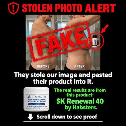 SK Renewal 40™ — Advanced Keratolytic Cream For Rough, Raised Seborrheic Keratoses