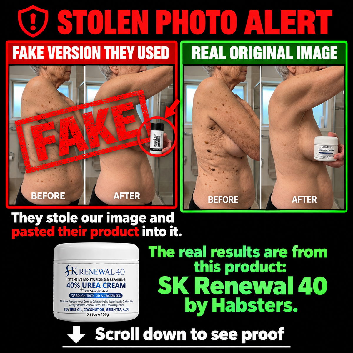 SK Renewal 40™ — Advanced Keratolytic Cream For Rough, Raised Seborrheic Keratoses